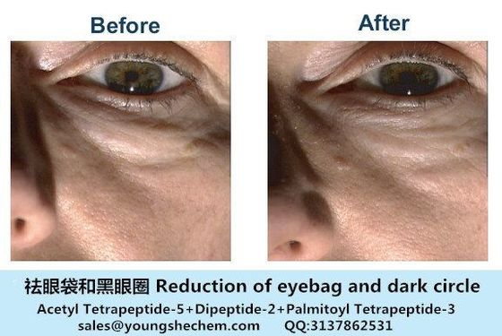 White color Dipeptide-2/eyeliss Cas 24587-37-9 for eyebag treatment with good price